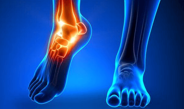 visit an ankle fracture specialist