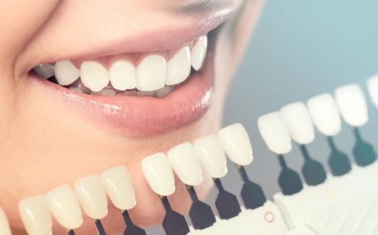 Can Cosmetic Dentistry Fix Crooked Teeth