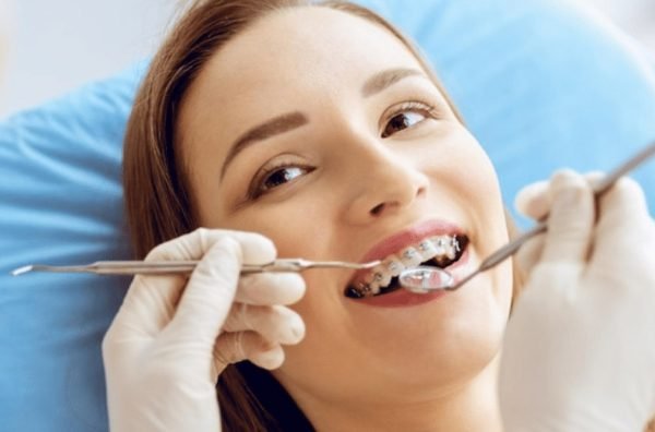 Finding the Perfect London Orthodontist